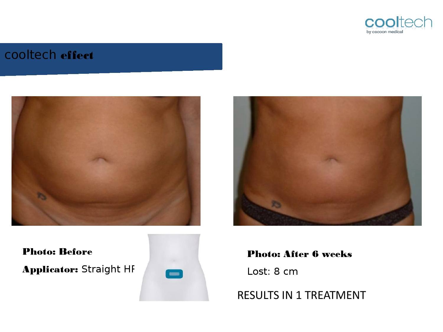 Presentation Cooltech ENG Wigmore Days Novaaaa1-page-011